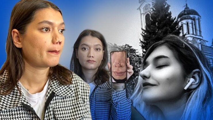 Estetik ameliyatı sonrası hayatı kâbusa döndü! Burnunun uç kısmında çökme meydana geldi… Milyonluk tazminat davası açtı
